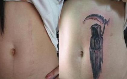 南京哪家醫(yī)院做隆鼻好？選擇哪家醫(yī)院效果最好，價(jià)格又合理又安全