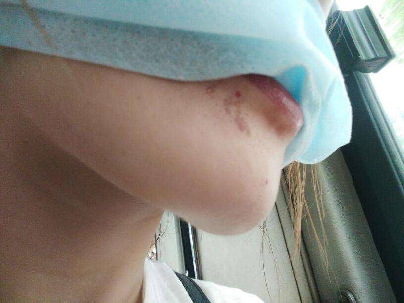 2023河北鐳射激光開眼角正規(guī)專家評分(陳瑞娟、高俊英、曾慶明實力表現(xiàn)亮眼)