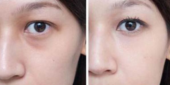 重慶修復(fù)疤痕哪家醫(yī)院好？專業(yè)推薦重慶治療疤痕效果好的醫(yī)院