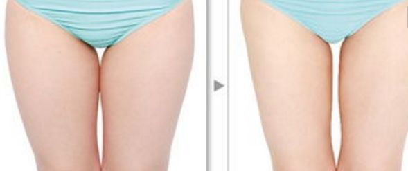 珠海做美容哪家醫(yī)院好？綜合用戶口碑推薦