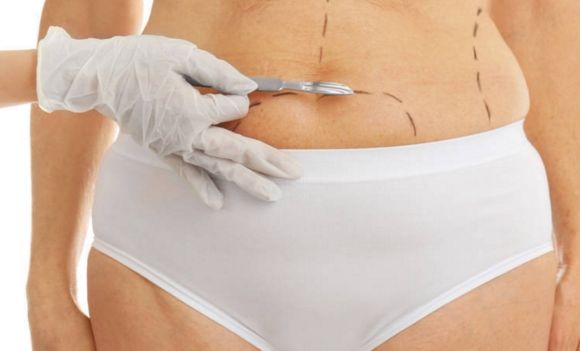 自貢哪家醫(yī)院做雙眼皮效果好？