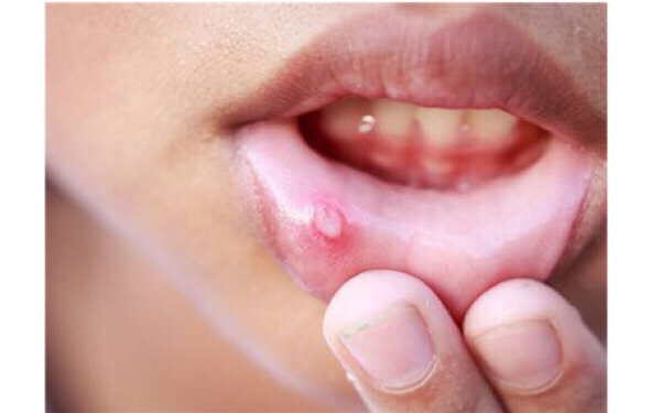 2023長沙熊貓針去眼睛細紋權威專家上榜TOP10強(肖培衛(wèi)、秦曉東、陳鵬麗收費不坑人)