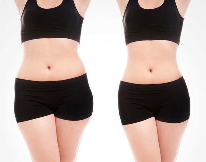 2023廣州頸紋填充嗨體正規(guī)醫(yī)生口碑(王志軍、伍明政、李翠華全新實(shí)力曝光)