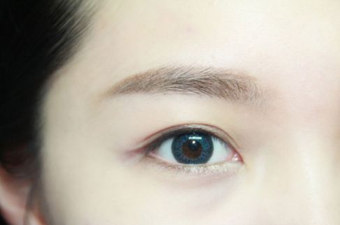 寧波哪家醫(yī)院割雙眼皮效果好？