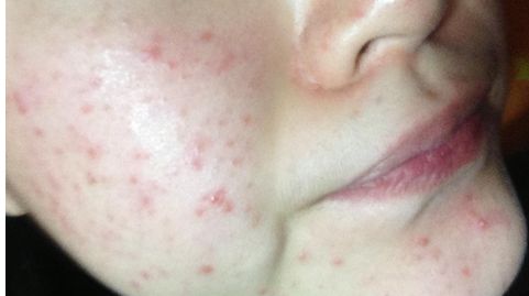 北京豐臺右安門醫(yī)院醫(yī)生好不好？服務(wù)口碑如何？