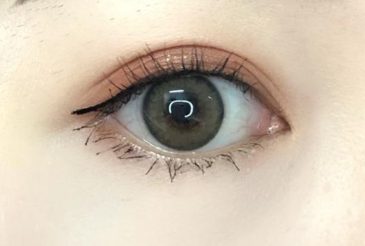 如何評(píng)價(jià)深圳和協(xié)醫(yī)院的脂肪填充手術(shù)？費(fèi)用是多少？醫(yī)生資質(zhì)如何？