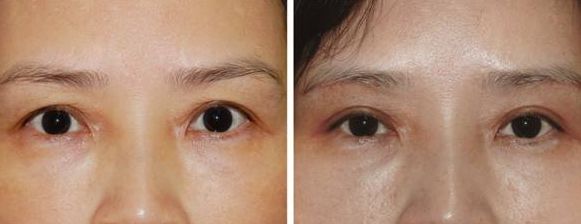 上海激光美容醫(yī)院排名及熱門選擇，哪家好？