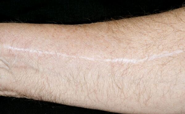 2023成都膠原蛋白去木偶紋醫(yī)生TOP10口碑榜(苗劉玉、周齊鳴、陳謝娟價(jià)格收費(fèi)不稀奇~)