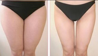 如何評(píng)價(jià)廣州珈禾整形醫(yī)院的口碑和質(zhì)量？