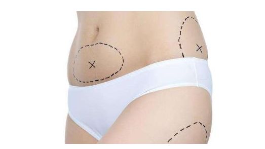 上海哪家醫(yī)院的祛眼袋手術(shù)效果最好？讓您的眼睛重獲明亮與青春