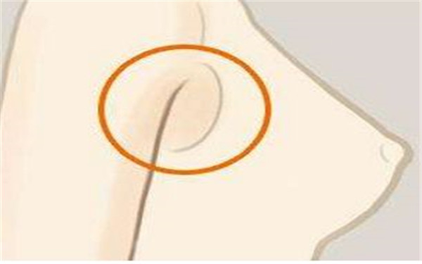 范巨峰醫(yī)生個(gè)人故事：驚艷雙眼皮案例與專業(yè)實(shí)力！