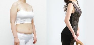 成都做雙眼皮，哪家醫(yī)院專業(yè)可靠？