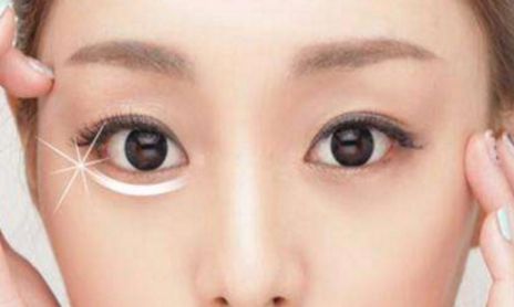 荊州割眼袋哪家醫(yī)院好？眼袋修復(fù)專家為您推薦！