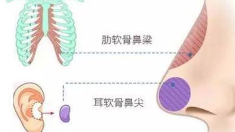 廣州有哪些醫(yī)院可以進(jìn)行抽脂手術(shù)？