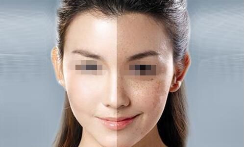 南昌哪家醫(yī)院做光子嫩膚好？選擇南昌哪家醫(yī)院光子嫩膚效果最佳