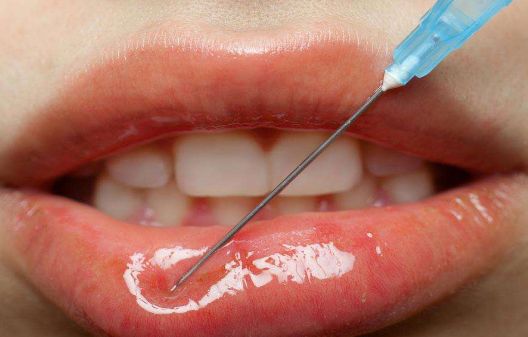 南京鼻梁塌醫(yī)院哪家好？南京鼻梁塌矯正醫(yī)院排名及選擇技巧分析