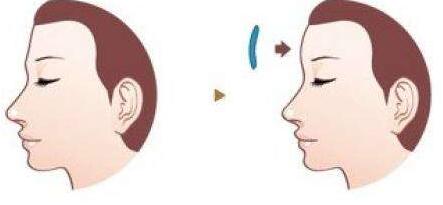 廣州整容行業(yè)的5位醫(yī)生，為你推薦熟悉整圈內(nèi)的大咖！