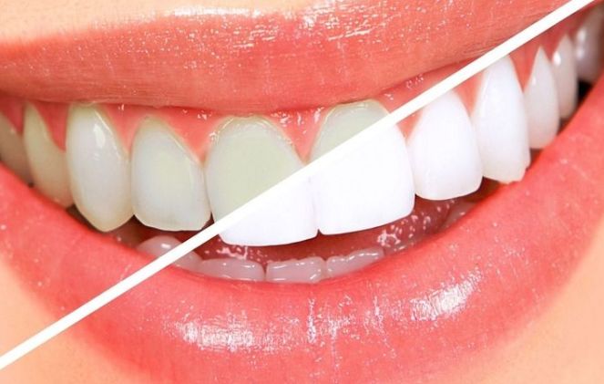 天津哪家醫(yī)院看鼻腔好？癥狀嚴(yán)重時如何尋找專業(yè)醫(yī)院治療？