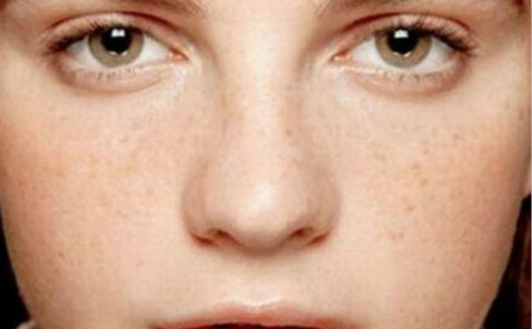 2023上海骨膜下隆鼻整形權(quán)威專家上榜前10名(李哲權(quán)、張瑞紅、劉超口碑擅長、價格簡介盤點(diǎn))