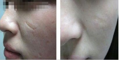 湖北棗陽(yáng)整形醫(yī)院哪家最值得信賴？