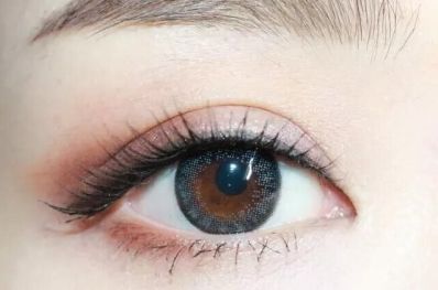 如何選擇德陽切開雙眼皮專家？評估這些因素找到最好的醫(yī)院！