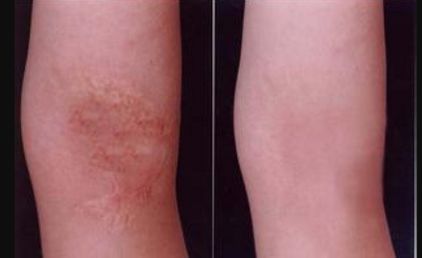 重慶整形醫(yī)院哪家效果好？權(quán)威排行榜來告訴你！