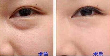 杭州整形美容界大咖PK，曾海峰、河東鎬、高俊明，想知道磨骨哪個醫(yī)生靠譜？