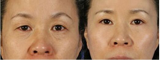 南京硅膠隆鼻哪家醫(yī)院好？斯景醫(yī)療專家推薦！