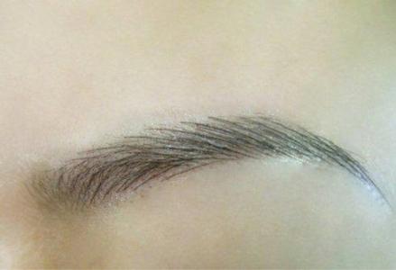 深圳貝加美：一站式醫(yī)療美容專家丨豐富價格表丨祛斑激光療程分享