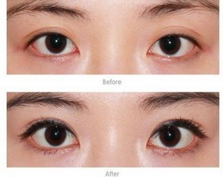 武漢處女膜修復哪家好？專業(yè)修復機構推薦詳細比較