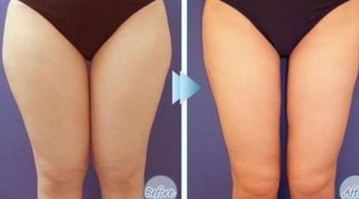 哪位醫(yī)生在北京八大處做拉皮手術(shù)效果好？馬繼光的資歷和費(fèi)用情況有哪些？