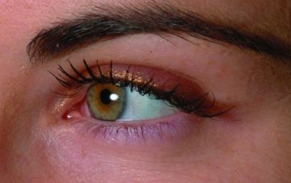 上海哪家醫(yī)院治療疤痕效果好？上海三甲疤痕醫(yī)院哪家最受歡迎？