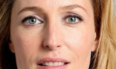 北京協(xié)和醫(yī)院整形科的拉皮效果好嗎？