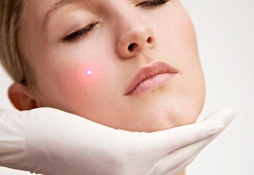 2023上海韓式下頜角瘦臉正規(guī)醫(yī)生排行前幾(陳春水、王海、李衡華技術(shù)成熟優(yōu)勢多)