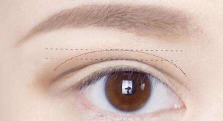 杭州劉軍鼻子塑形效果如何？個(gè)人簡(jiǎn)介、醫(yī)院、費(fèi)用詳情先給您解答