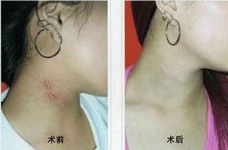 南寧哪家醫(yī)院治痘效果好？選擇明星們的美肌秘密推薦的南寧優(yōu)質(zhì)醫(yī)院