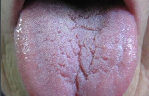 2023湛江溶脂去眼袋手術(shù)top10強(qiáng)醫(yī)生(朱本谷、趙璽耀、張俊優(yōu)質(zhì)醫(yī)美價(jià)格公道)