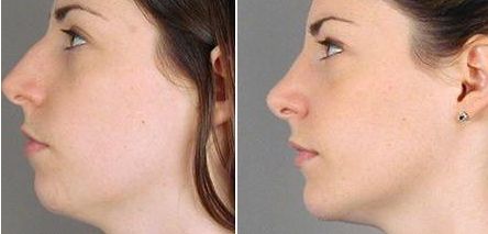 上?？簇惪损肽募裔t(yī)院好？選個靠譜的！