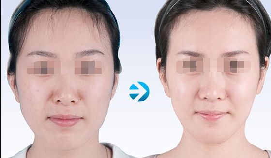 蘇州哪家吸脂好又實(shí)惠？專業(yè)美容機(jī)構(gòu)為您推薦