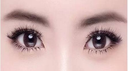 南寧自體填充淚溝哪家好？探索最佳南寧自體填充淚溝選擇