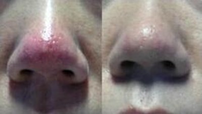 福州哪家醫(yī)生做隆胸技術(shù)好？推薦五位專業(yè)醫(yī)師，價(jià)格參考！