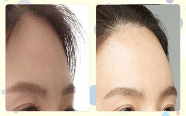 全國整容醫(yī)生PHD公開名單，創(chuàng)新技術(shù)行業(yè)新標(biāo)桿