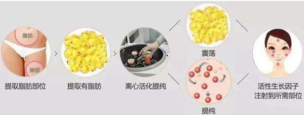 哈爾濱哪家醫(yī)院的去皺針效果好？