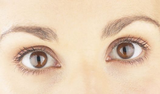 南寧哪家祛痘的醫(yī)院好？找到最適合您的祛痘專家！