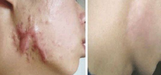 ?？谑姓吾t(yī)院哪家好？專家推薦最具口碑的?？谡吾t(yī)院有哪些？