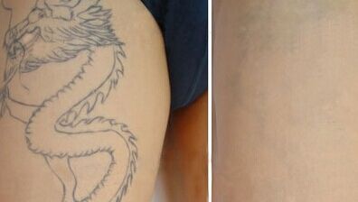 南京哪家醫(yī)院做面部提升效果最好？