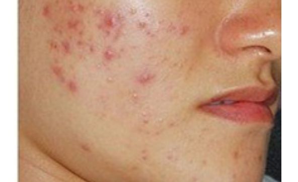 想了解寧波慈溪圣愛醫(yī)院醫(yī)療美容整形科價格表？醫(yī)生口碑如何？