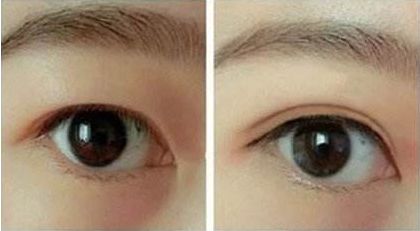 合肥哪家整形醫(yī)院好口碑好服務好值得推薦？