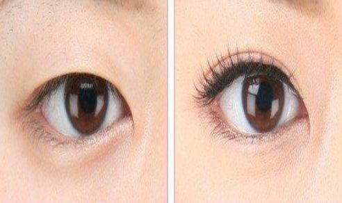 南昌市哪家醫(yī)院去痘好？專家推薦的南昌市治療痘痘的一流醫(yī)院有哪些