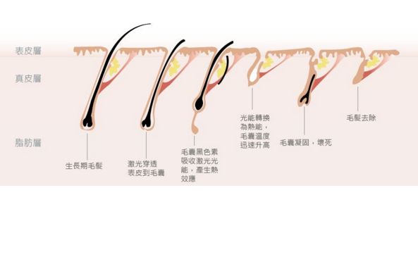 深圳哪家激光祛斑醫(yī)院口碑好？
